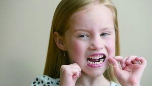 所有牙医都说，孩子必须必须每天用牙线，别偷懒只刷牙了事