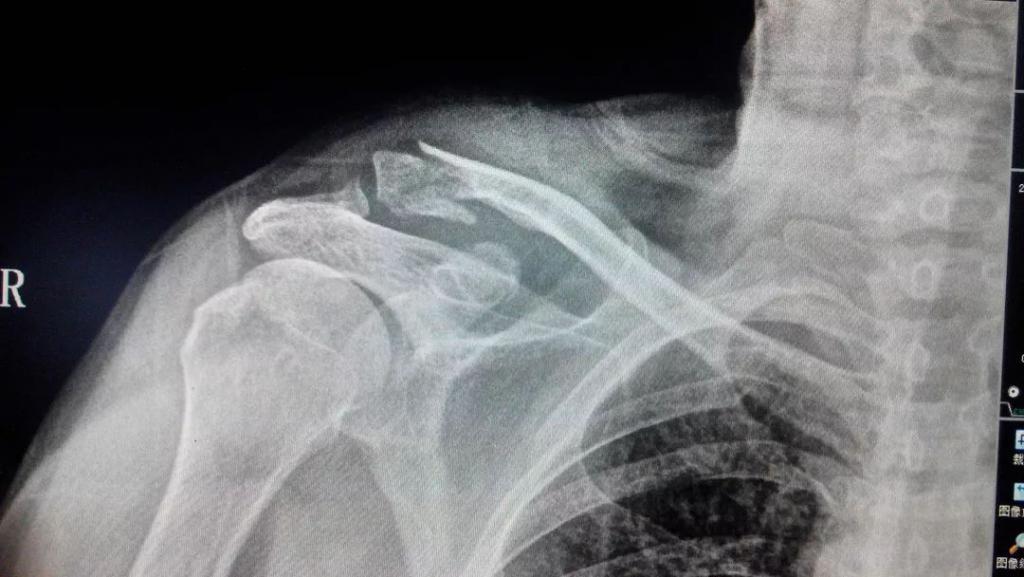 【ZAKER网】什么？开这些车会致癌、脱头发？