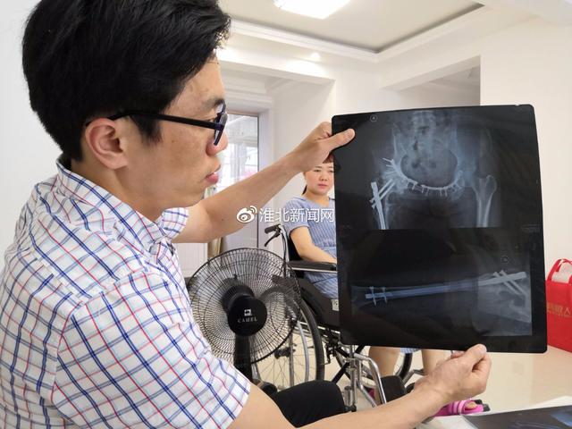 畅行淮北：女子车祸致残 男友为爱与其携手步入婚姻殿堂