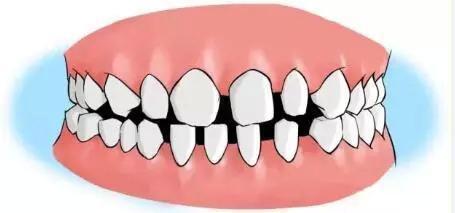 缺牙=毁容丨关于缺牙你不知道的事，正在慢慢毁了你！