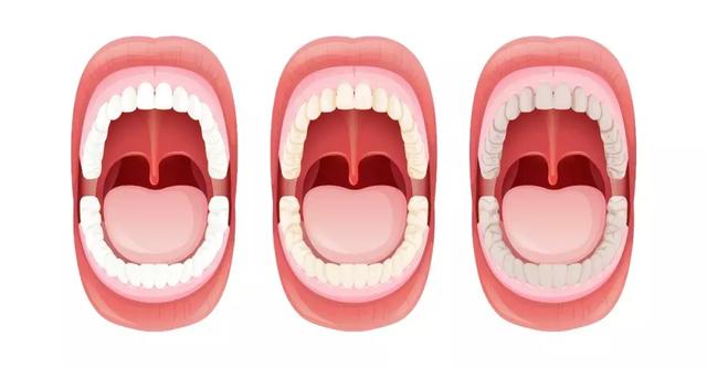 唇红齿“黄”？好牙变黄的原因是什么？