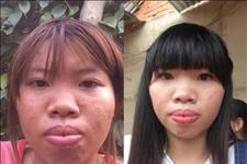 国外那些事儿：丑姑娘花9万整容后嫁给富二代 生完孩子后离婚如今有了新恋情