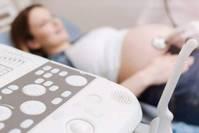 孕期每个时期有不同的产检项目，有1项，建议孕妈妈真的不能漏检