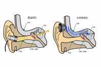 骨传导耳机对大脑危害吗？骨传导耳机的优缺点