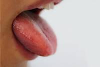 舌苔发白、发黄、发黑分别代表了身体的什么问题？不懂的都看看