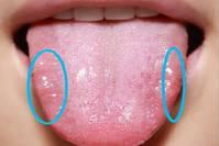 春季养肝，认准肝气郁结4个阶段，参考舌象选择对应的中成药